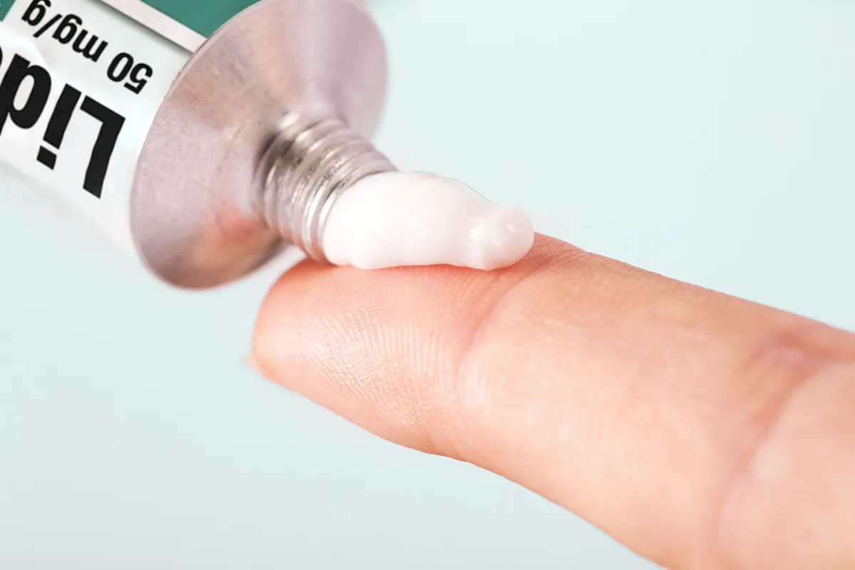 Nahaufnahme eines Zeigefinger, auf den Salbe aus einer Lidoproct Tube gedrückt wird